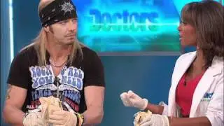 Bret Michaels: PFO