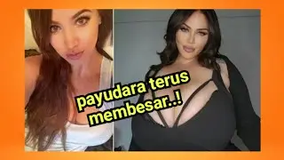 Payudara terus tumbuh, gadis ini merasa tersiksa | pamelia j