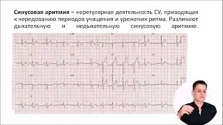 ЭКГ за 100 минут №4: Нарушения ритма на ЭКГ