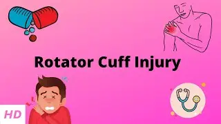 Rotator Cuff Injury, Causes, Signs and Symptoms, Diagnosis and Treatment.