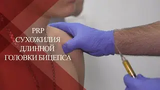 💉PRP при повреждении вращательной манжеты плеча суставной губы и сухожилия| Теносиновит