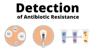 Detection Methods for Antibiotic Resistance