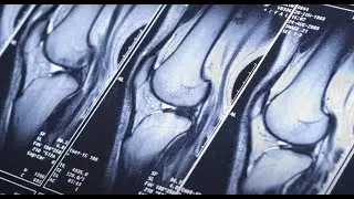 МРТ. Зачем это исследование? Прямой эфир Михаила Касаткина и Романа Бартенева