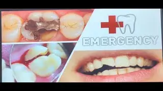 Emergency Management Dental