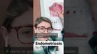 Painful Periods & Endometriosis!