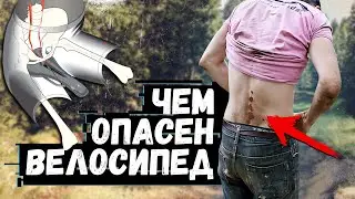 Все о велосипедных травмах: как мы их получаем и как их избежать