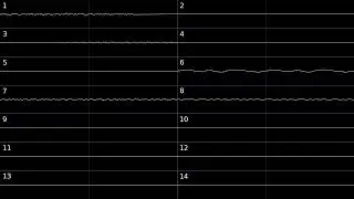 Big Money Deluxe Puzzle music (Oscilloscope View)