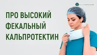 Высокий ФЕКАЛЬНЫЙ КАЛЬПРОТЕКТИН. К какому доктору обратиться за лечением?