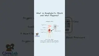 What is anaphylactic shock, and what happens? 