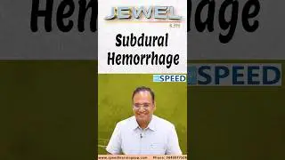 Subdural Hemorrhage by Dr.K.Vinayak Senthil., #neetss #iniss #medico #neetpg