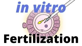 In Vitro Fertilization (IVF) explained