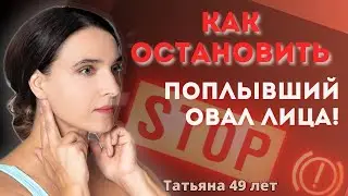 Поплыл овал лица! Что делать?Реальный разбор по фото.