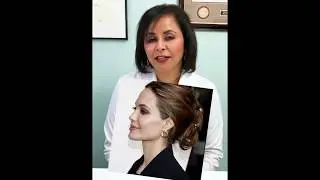 Jaw + Chin Contouring w/ Fillers | Dr. Usha Rajagopal