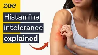 The surprising truth about histamine intolerance | Dr. Will Bulsiewicz