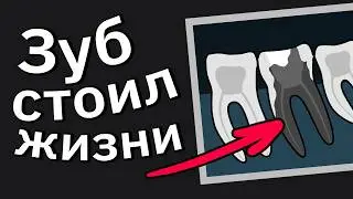 Врачи Сливают Моменты "Чёрт, Всё Намного Хуже, Чем Я Думал"