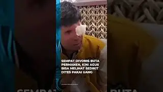 Sempat Divonis Buta Permanen, Kini Agus Bisa Melihat Melihat Sedikit Dites Pakai Uang