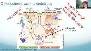 Biomarkers and Biologics in Asthma