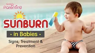 Easy Tips & Precautions for Baby Sunburn