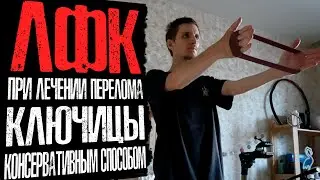 ЛФК после перелома ключицы | Кольца Дельбе, реабилитация