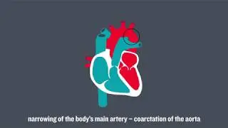 Congenital Heart Conditions