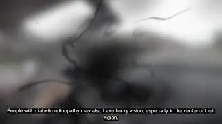 (Audio Described) See What I See: Diabetic Retinopathy Virtual Reality Experience