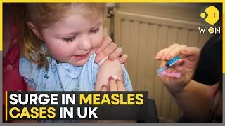 UK Measles Outbreak: Most cases reported in children under 10 years of age | WION News