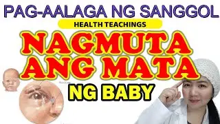 NAGMUMUTA ANG MATA NI BABY I LUHA AT MUTA SA MATA NI BABY I MUTA SA MATA NG BATA I SANGGOL TIPS