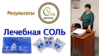 NAYUTA  РЕЗУЛЬТАТЫ ПРИМЕНЕНИЯ СОЛИ880 ПРИ УДАЛЕННОМ ЖЕЛЧНОМ ПУЗЫРЕ    НАЮТА