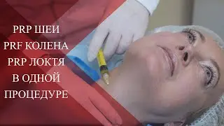 💉PRP терапия в косметологии | PRF методика при патологии суставов | Про мой опыт