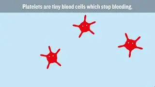 What causes DVT and how can we stop it?