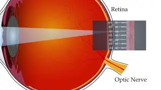 How does an artificial retina work? (audio described version)