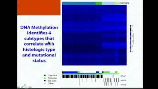 TCGA: Papillary Thyroid Carcinoma Analysis - Thomas Giordano