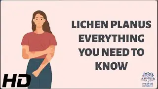 Unlocking the Mystery of Lichen Planus : Everything You Need to Know