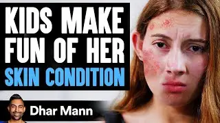 Kids MAKE FUN Of Girls SKIN CONDITION, What Happens Is Shocking | Dhar Mann