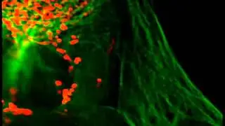 Mitochondrial transport along microtubules