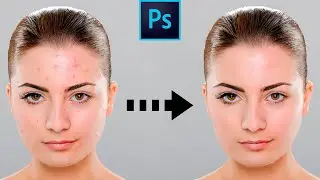 How to Remove Acne in Photoshop | Photoshop Tutorial