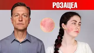 Если у вас розацеа, то ЭТО поможет. 🙌