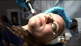 Dr. Max Gomez: Acne Scar Treatment