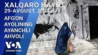 Xalqaro hayot - 29-avgust, 2024-yil - Afg'on ayolining ayanchli ahvoli