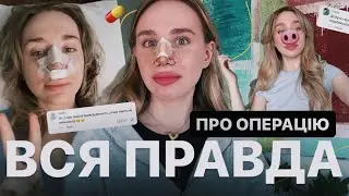 ЧОМУ Я ЗРОБИЛА РИНОСЕПТОПЛАСТИКУ? 👃🏻| все про операцію та мій досвід