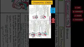 Cyanotic CHDs