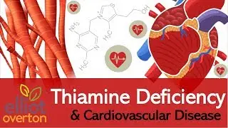 Vitamin B1 (Thiamine) Deficiency: Cardiovascular & Circulatory Diseases