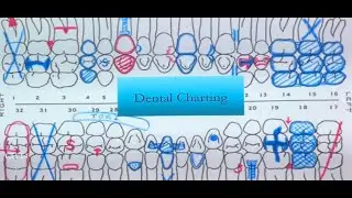 Dental Charting