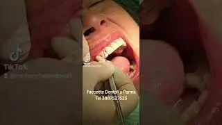 Traaforma la tua nuova immagine con noi dai denti alle labbra occhiaie mento zigomi pelle a Parma