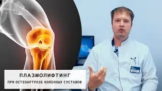 Плазмолифтинг суставов при Остеоартрозе | Лечение коленных суставов