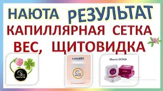 НАЮТА- КАК СНИЗИТЬ ВЕС,УБРАТЬ КАПИЛЛЯРНУЮ СЕТКУ,ОТКАЗАТЬСЯ ОТ ОПЕРАЦИИ НА ЩИТОВИДКЕ.NAYUTA