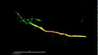 Real-time visualization of neuronal growth cone dynamics