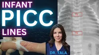 IDEAL position of NEONATAL PICC lines on X-ray!!!