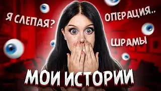 МОИ ИСТОРИИ! (операция, шрамы, я слепая?)