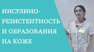 Инсулинорезистентность и образования на коже